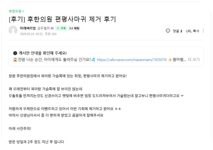 창원 후한의원 목 가슴 쥐젖 편평사마귀 제거 후기