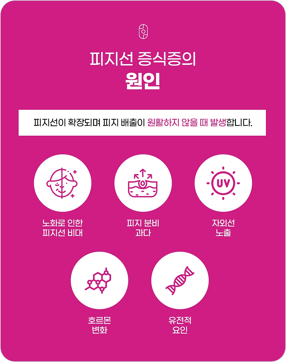 창원피지선증식증과 원인 정리 이미지