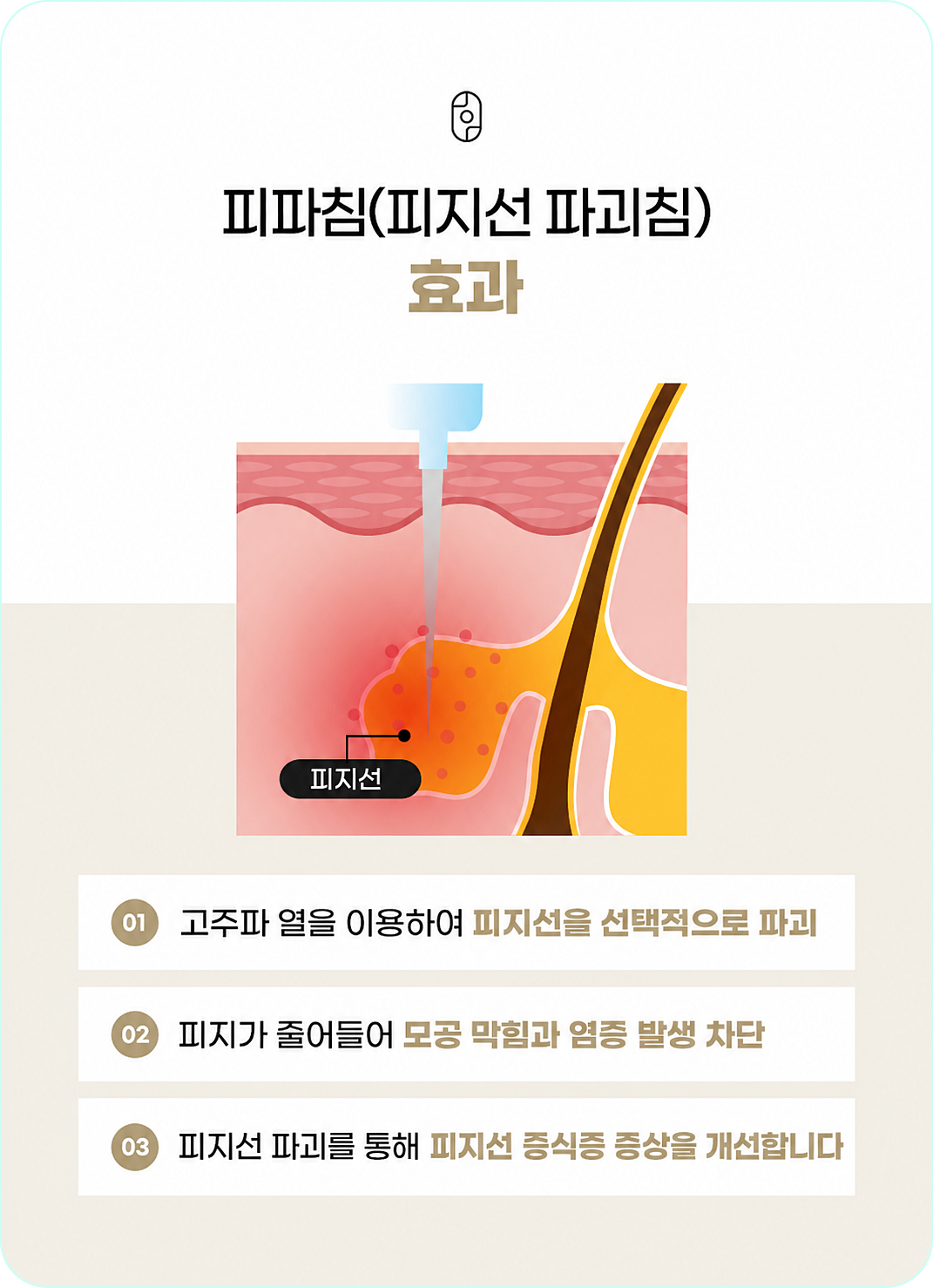 창원피지선증식증 효과 관련 설명 이미지