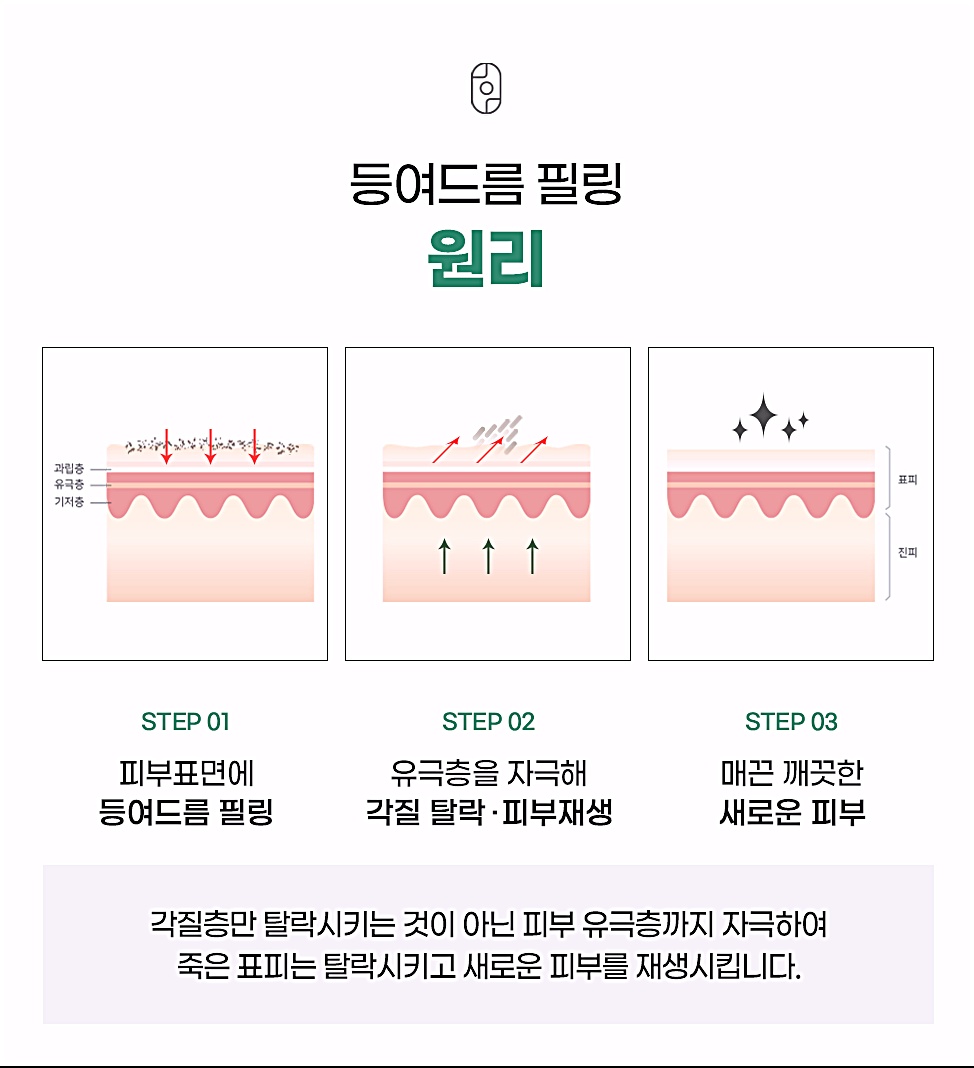 창원 등여드름 필링의 원리를 STEP 01~03 단계로 정리한 설명