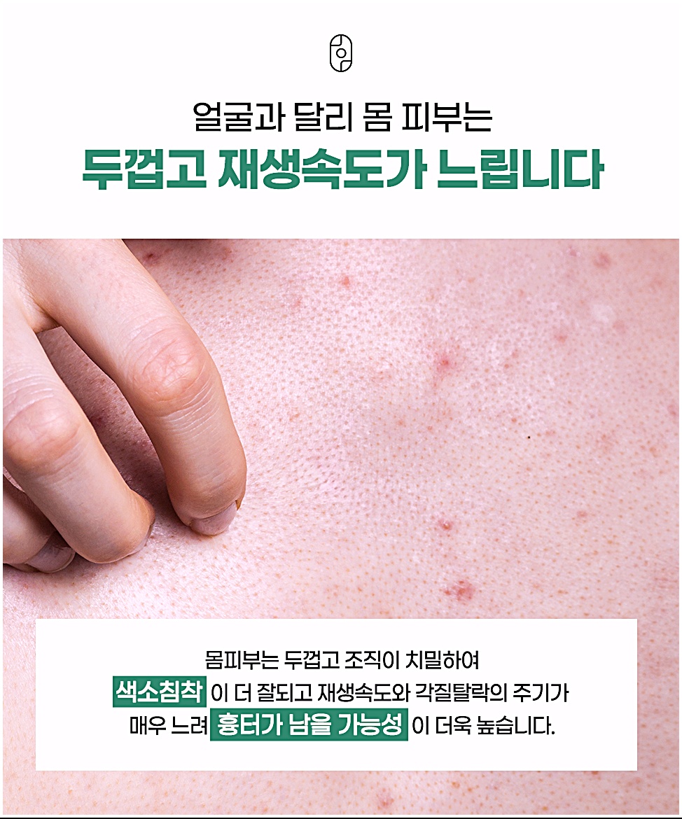 몸 피부는 얼굴보다 두껍고 조직이 치밀해 색소침착과 흉터가 남기 쉽다는 설명