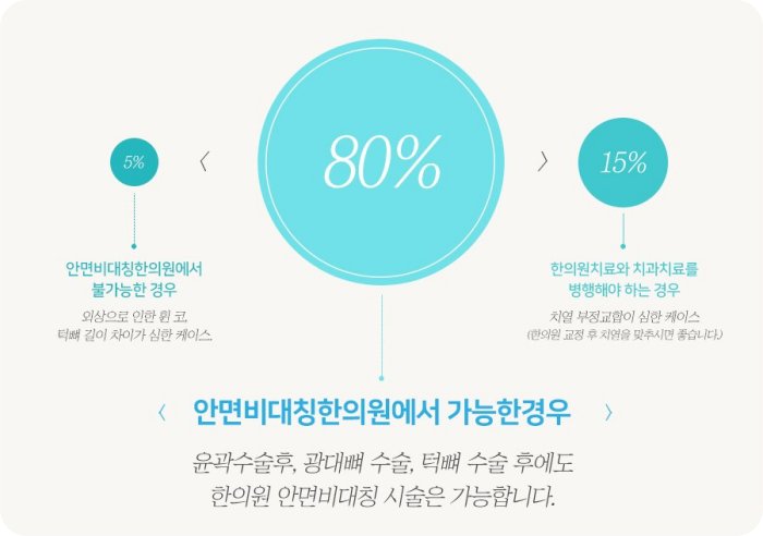 안면비대칭교정 비율 인포그래픽 - 수술 5%, 비수술 80%, 복합치료 15%