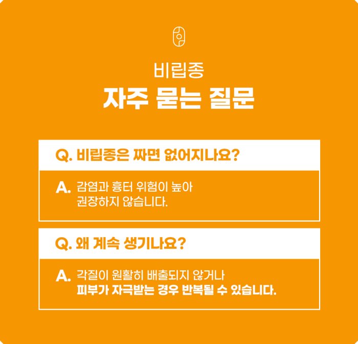 창원비립종 자주 묻는 질문