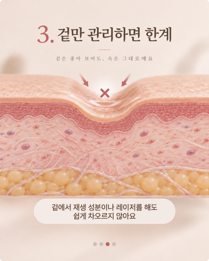 창원여드름흉터 치료의 한계 설명 - 