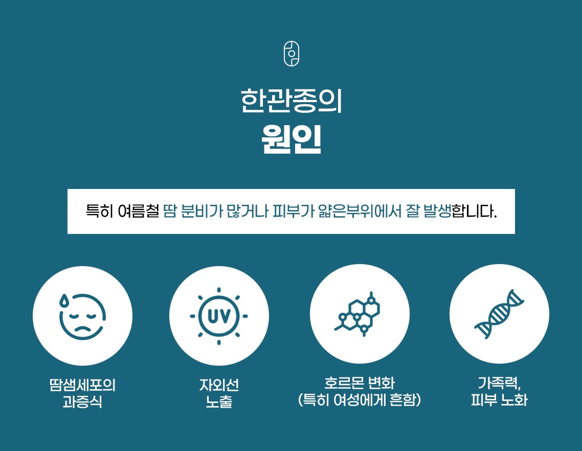 한관종 발생 원인과 땀샘 세포 과증식