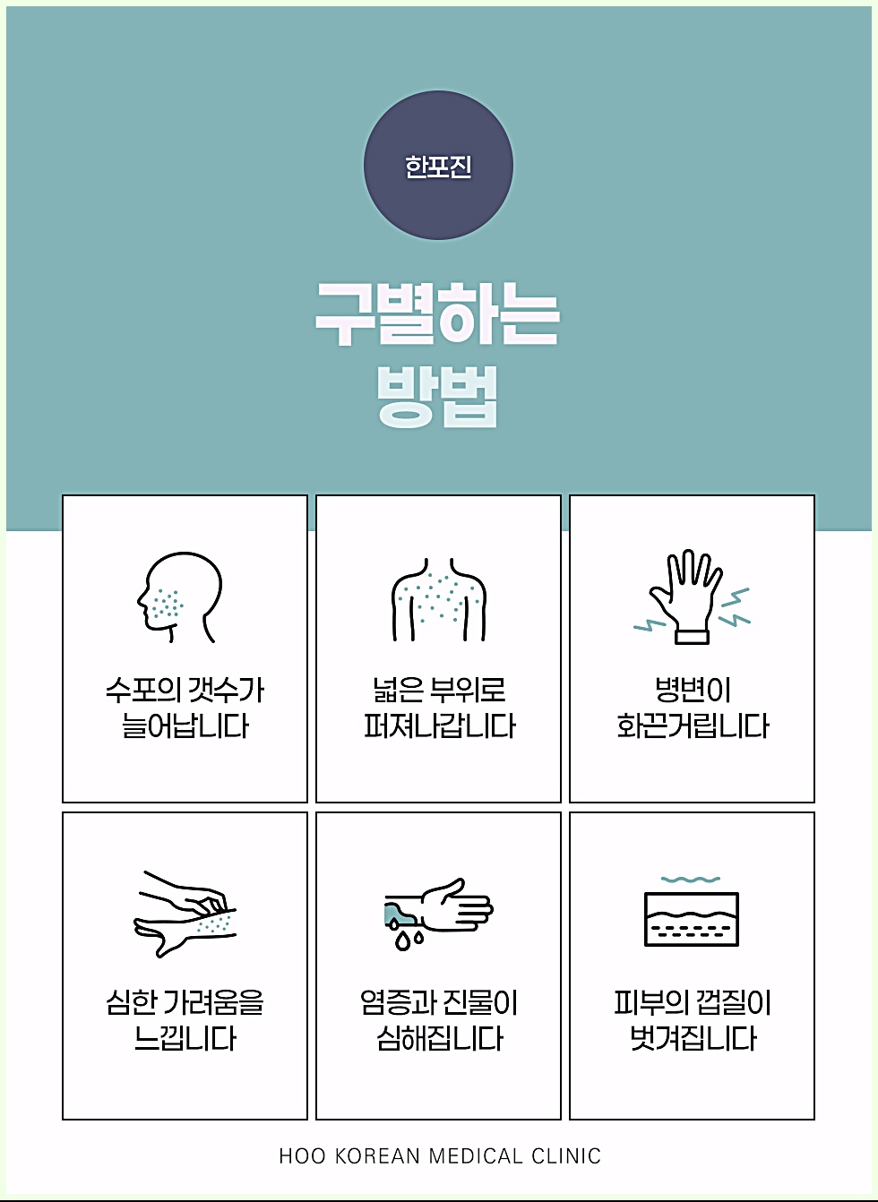 창원한포진 구별하는 방법 - 수포 증가, 확산, 가려움, 염증 등 6가지 신호