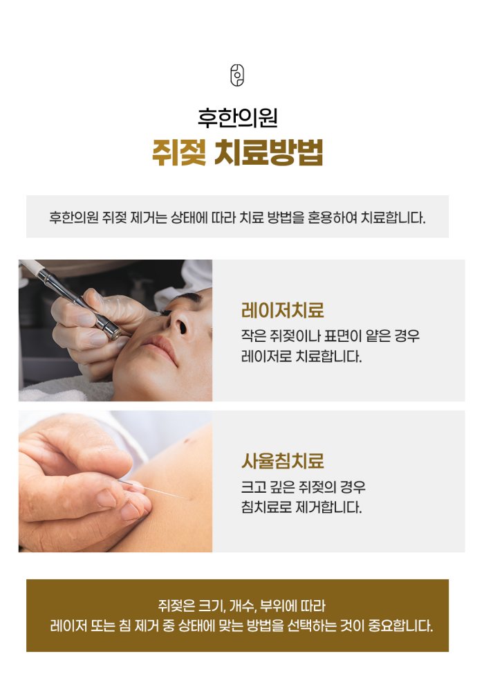창원 쥐젖제거 레이저 침치료 방법