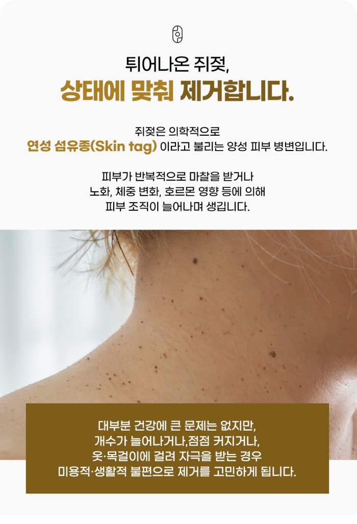 창원 쥐젖에 대한 설명