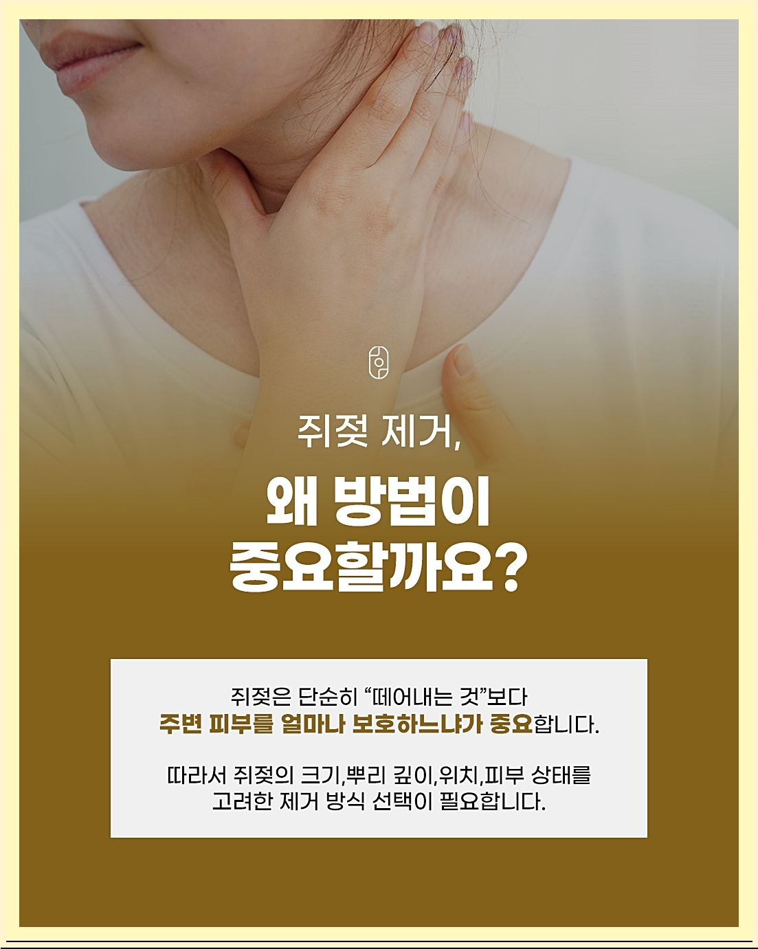 쥐젖제거 방법이 중요한 이유