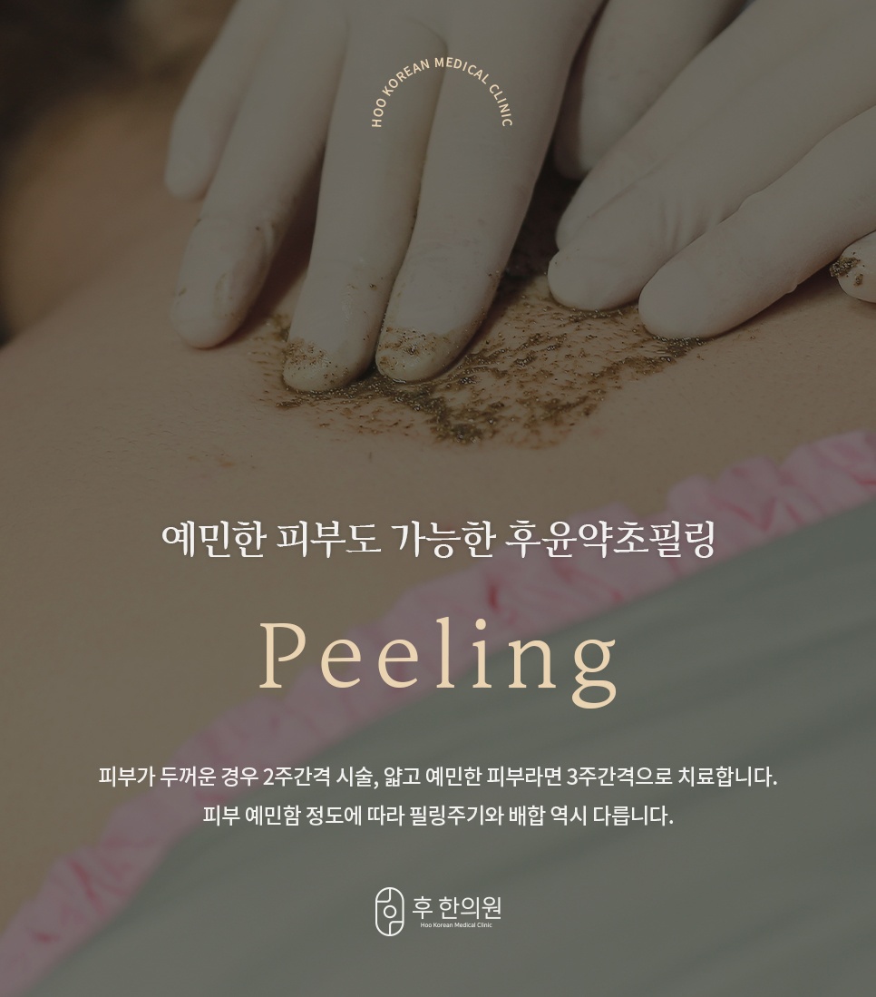 등 피부에 약초 필링제를 펴 바르는 예민한 피부용 후윤약초필링