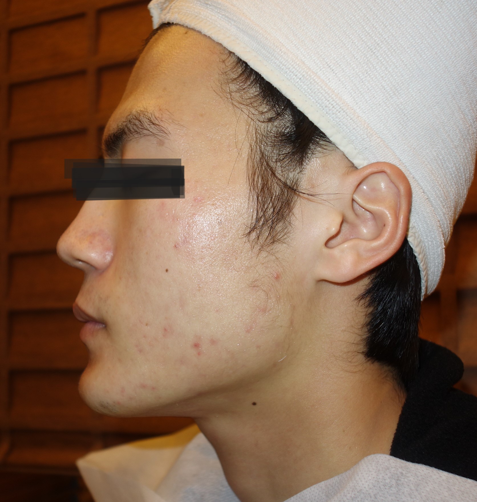 After