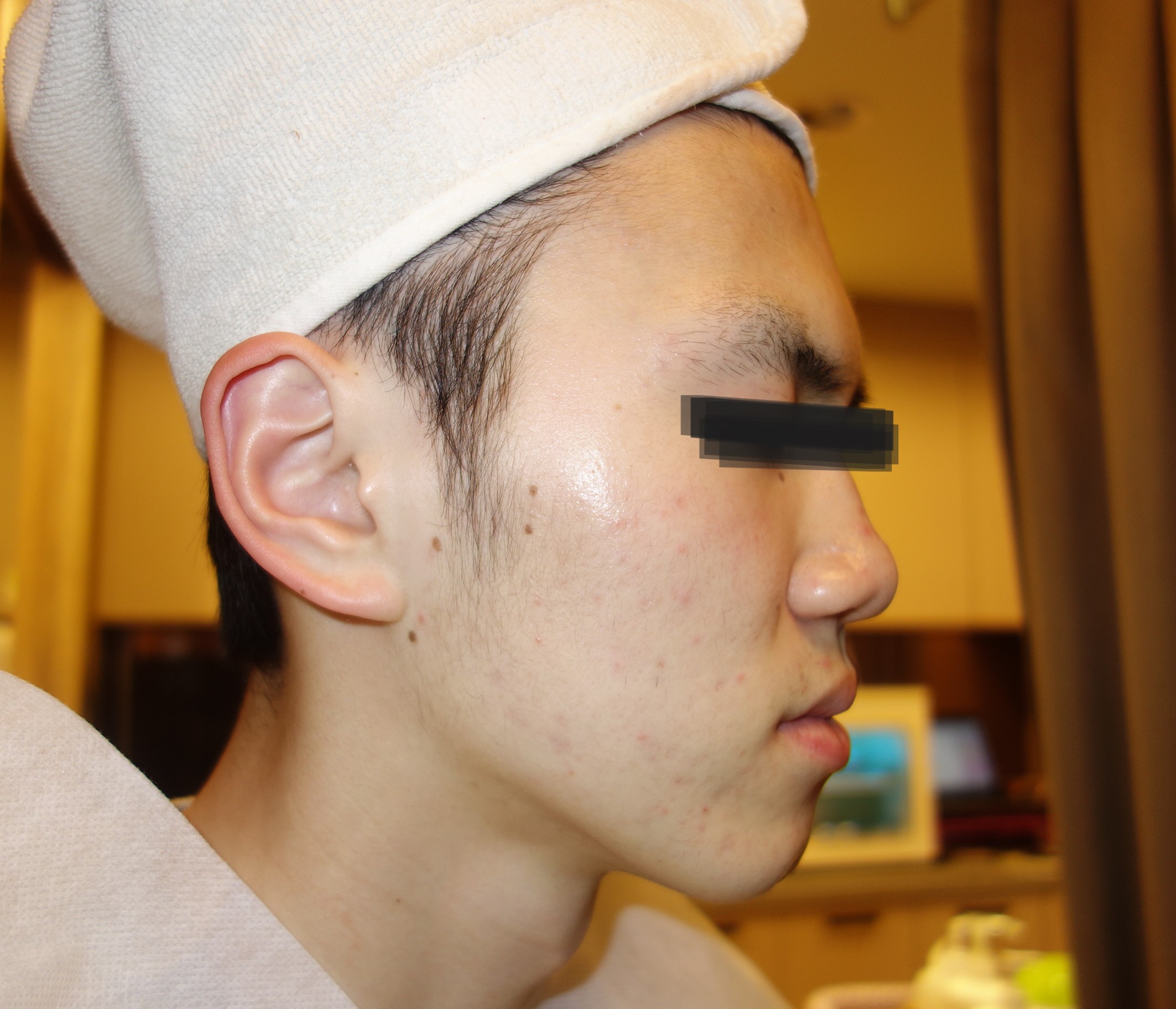 After